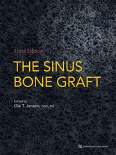 The Sinus Bone Graft