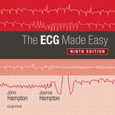 The ECG Made Easy E-Book