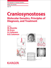 Craniosynostoses