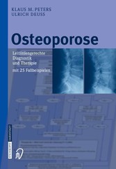 Osteoporose