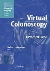 Virtual Colonoscopy