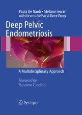 Deep Pelvic Endometriosis