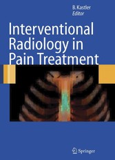 Interventional Radiology in Pain Treatment