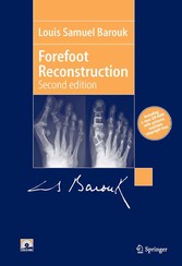 Forefoot Reconstruction