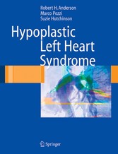 Hypoplastic Left Heart Syndrome