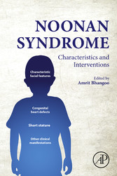 Noonan Syndrome