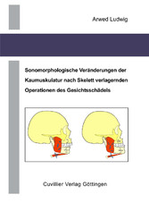 Sonomorphologische Ver&#xE4;nderungen der Kaumuskulatur nach Skelett verlagernden Operationen des Gesichtssch&#xE4;dels