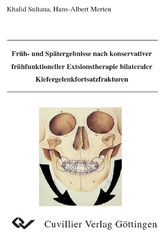 Fr&#xFC;h- und Sp&#xE4;tergebnisse nach konservativer fr&#xFC;hfunktioneller Extsionstherapie bilateraler Kiefergelenkfortsatzfrakturen