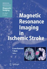 Magnetic Resonance Imaging in Ischemic Stroke