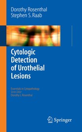 Cytologic Detection of Urothelial Lesions