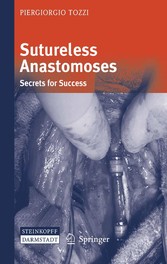 Sutureless Anastomoses