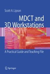 MDCT and 3D Workstations