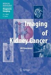 Imaging of Kidney Cancer