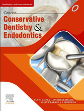 Concise Conservative Dentistry and Endodontics- E Book