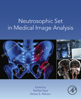 Neutrosophic Set in Medical Image Analysis