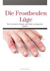 Die Frostbeulen Lüge