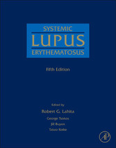 Systemic Lupus Erythematosus