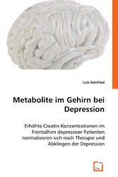 Metabolite im Gehirn bei Depression