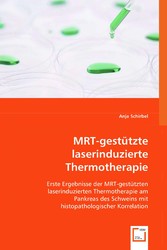 MRT-gestützte laserinduzierte Thermotherapie