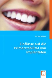 Einflüsse auf die Primärstabilität von Implantaten