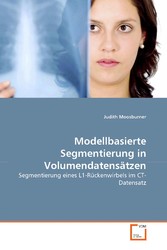 Modellbasierte Segmentierung in Volumendatensätzen