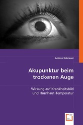 Akupunktur beim trockenen Auge