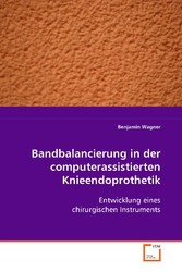 Bandbalancierung in der computerassistiertenKnieendoprothetik