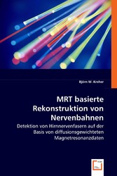 MRT basierte Rekonstruktion von Nervenbahnen