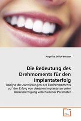 Die Bedeutung des Drehmoments für den Implantaterfolg