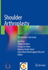 Shoulder Arthroplasty