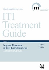 Implant Placement in Post-Extraction Sites