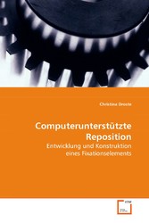 Computerunterstützte Reposition