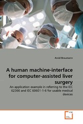 A human machine-interface for computer-assisted liver surgery