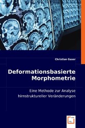 Deformationsbasierte Morphometrie