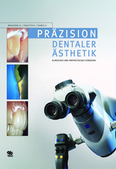 Präzision dentaler Ästhetik