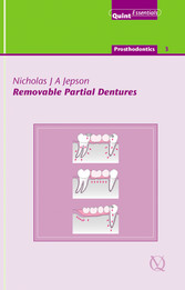 Removable Partial Dentures