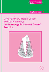 Implantology in General Dental Practice