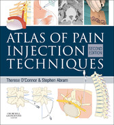 Atlas of Pain Injection Techniques E-Book