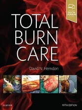 Total Burn Care E-Book