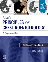 Felson's Principles of Chest Roentgenology E-Book