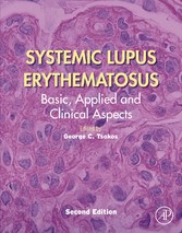 Systemic Lupus Erythematosus