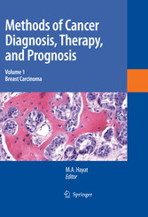 Methods of Cancer Diagnosis, Therapy and Prognosis