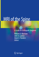 MRI of the Spine