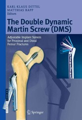 The Double Dynamic Martin Screw (DMS)