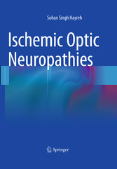 Ischemic Optic Neuropathies