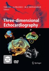 Three-dimensional Echocardiography