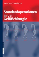 Standardoperationen in der Gefäßchirurgie