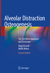 Alveolar Distraction Osteogenesis