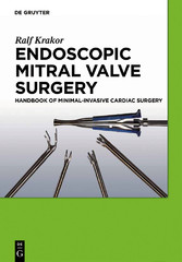 Endoscopic Mitral Valve Surgery