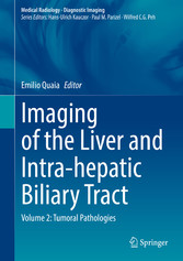 Imaging of the Liver and Intra-hepatic Biliary Tract